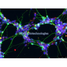 Human Motor Neurons (iPSC-derived, SOD1 mutant, A4V)